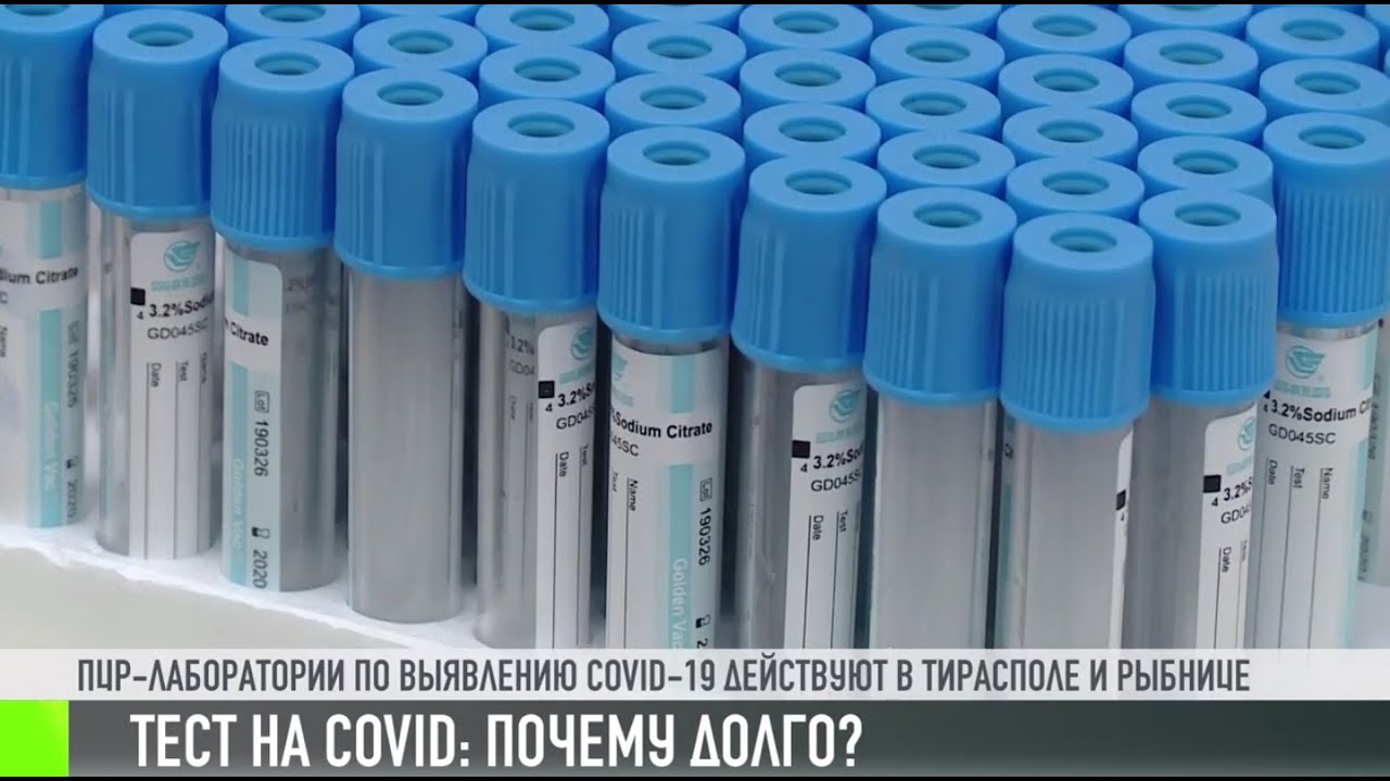 Тест на COVID: почему так долго?