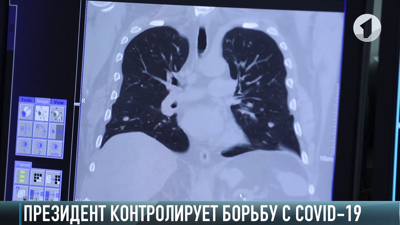 Томограф для Слободзеи и госпитали в районах